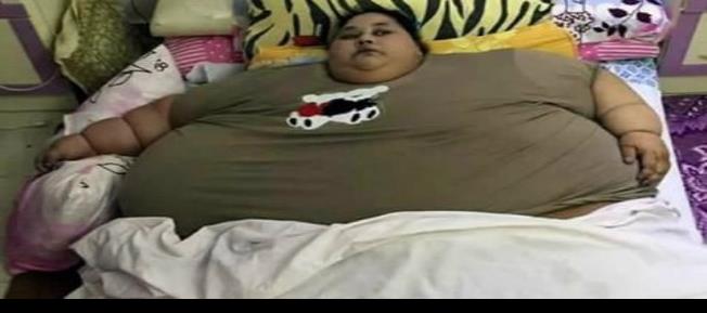 Pelean por operación a la egipcia más obesa, dicen que no bajó 250 kilos (+fotos sensibles)