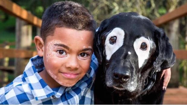 Perro con vitiligo logra que niño recupere su autoestima y ame sus manchitas