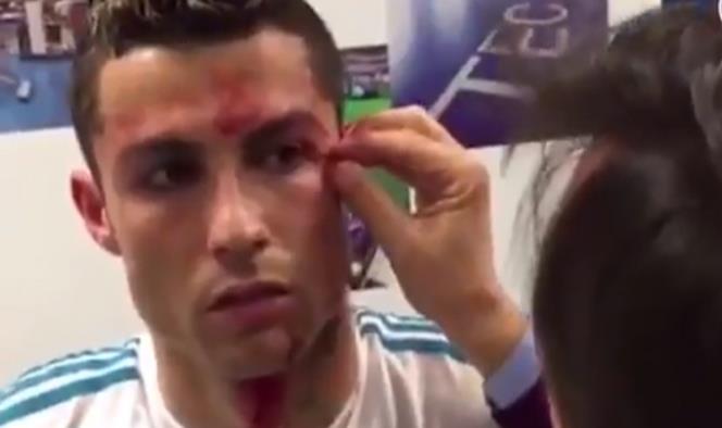 Así suturaron la herida de Cristiano Ronaldo en el vestidor del Real Madrid
