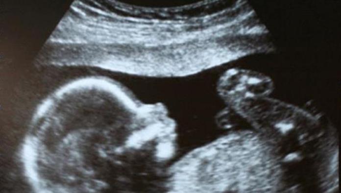 Médico queda sorprendido con lo que encontró en el útero de esta mujer