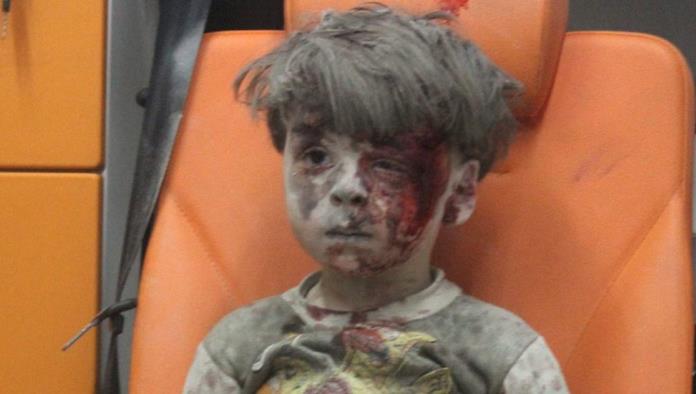 ¿Recuerdas a Omran, el niño sirio?, su tragedia aún no termina