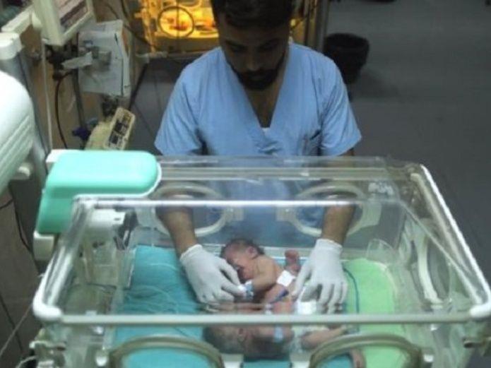 Las bebés siamesas de Gaza son separadas en exitosa cirugía