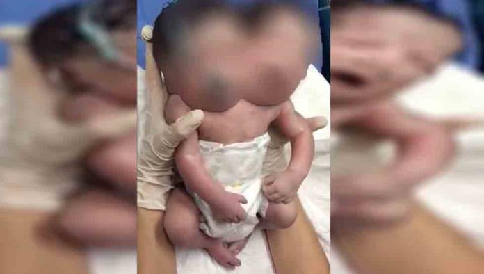 Reportan presunto nacimiento de bebé con dos cabezas en Ciudad Juárez