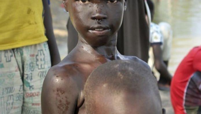 El cruel e incierto destino de los niños en Sudán