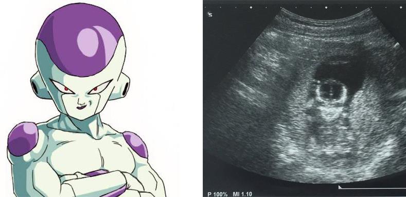 Mujer asegura estar embarazada de Freezer, personaje de Dragon Ball