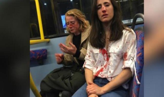 Golpean cruelmente a pareja de mujeres gay en Londres