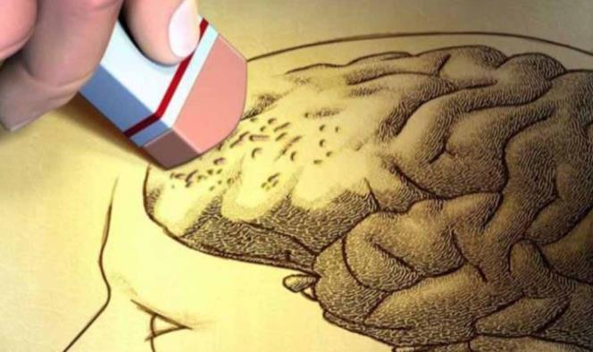 Hallan proteína del cerebro que retrasa avance del Alzheimer