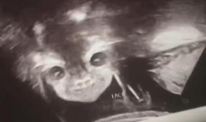 Captan aterradoras imágenes durante un ultrasonido