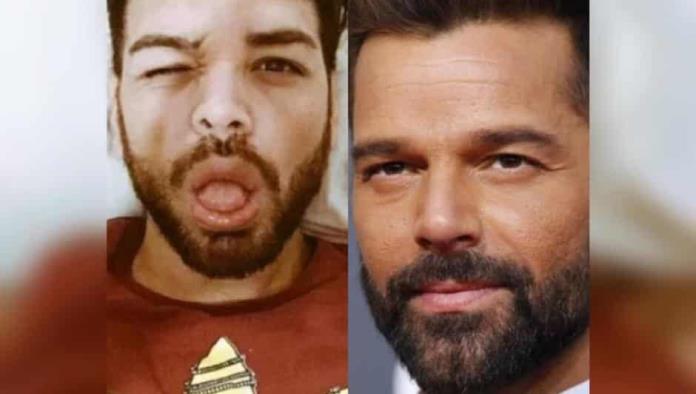 Se operó 27 veces para parecerse a Ricky Martin