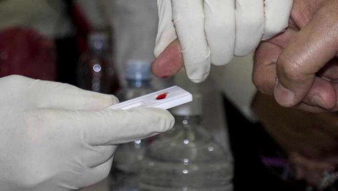 Registran 8 nuevos casos de VIH