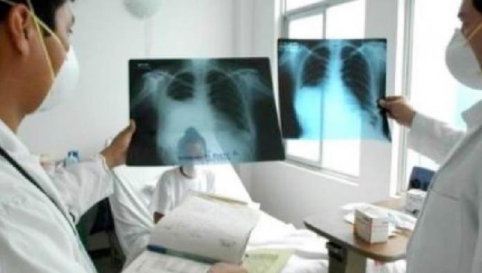 Campaña “Ponerle fin a la Tuberculosis”