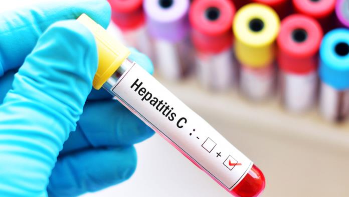 Realizarán rotarios campaña de detección de Hepatitis C