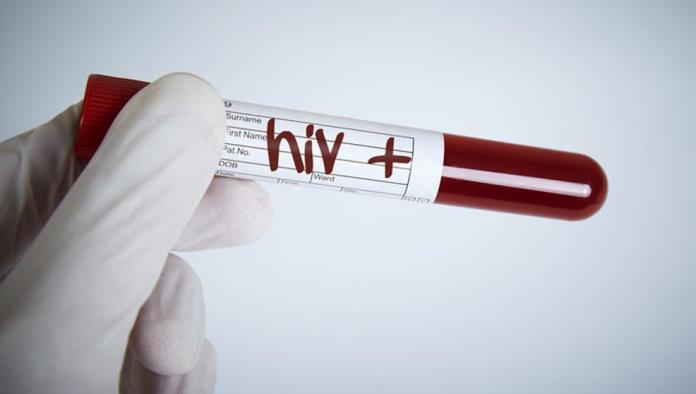 Trasplante de células madre podría eliminar el VIH del organismo