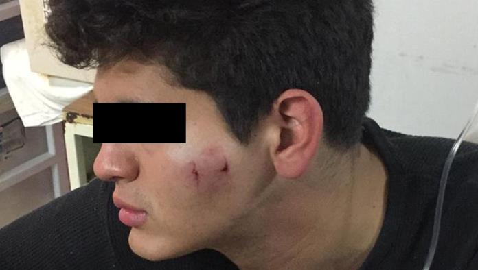 Estudiante de La Vizcaya resulta lesionado de un tubazo
