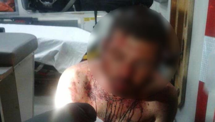 Joven golpeado en sector Villas del Carmen no ha denunciado