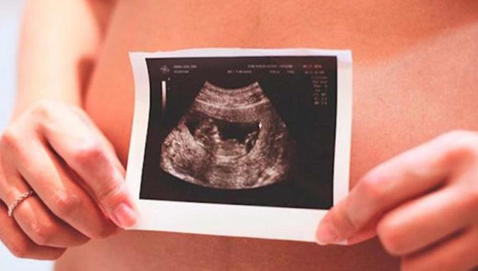 “Si madre está en resigo debe haber aborto”