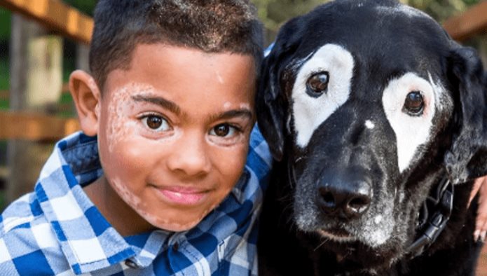 Niño conoce a un perro con su misma enfermedad y lo salva de la depresión