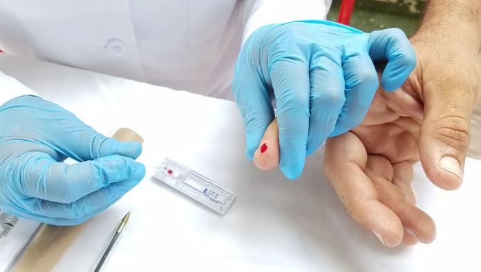 Realiza UNEME CAPASITS pruebas de VIH