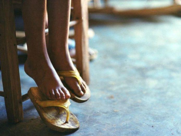 Niña de 4 años contrae mortal infección por probarse zapatos