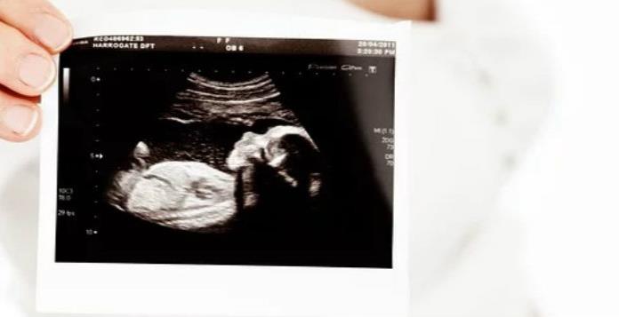 Presentan iniciativa para forzar a mujeres a ver su ultrasonido antes de abortar