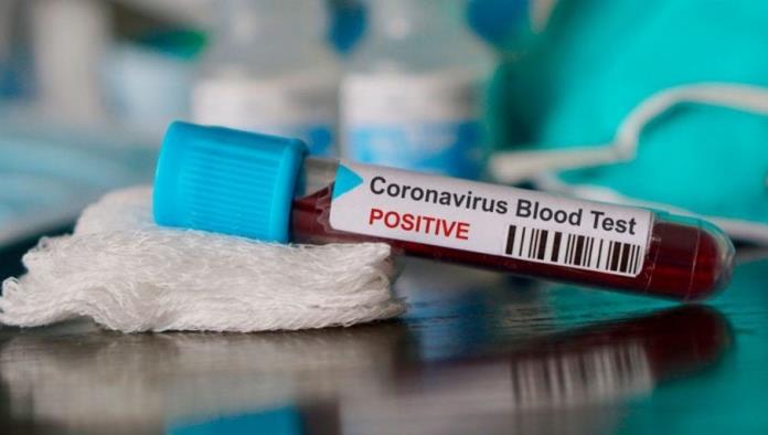 ¿Tu sangre es tipo A?... pues corres más riesgo de contraer coronavirus