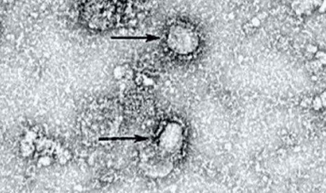 Así se ve el coronavirus desde el microscopio; primera foto