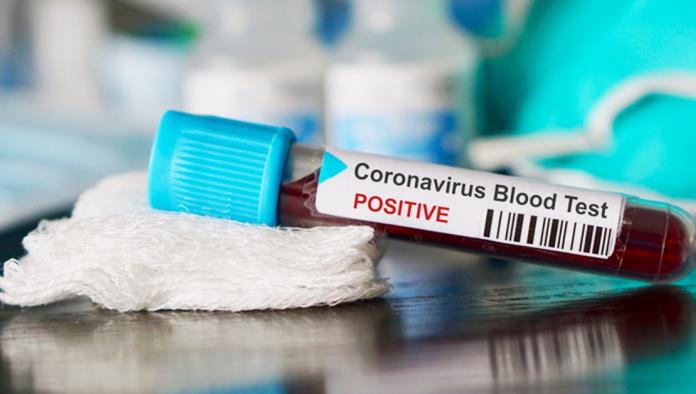 Vulnerables Hospitales ante el coronavirus
