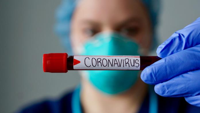 Mitos y preguntas usuales del coronavirus que causa el COVID-19