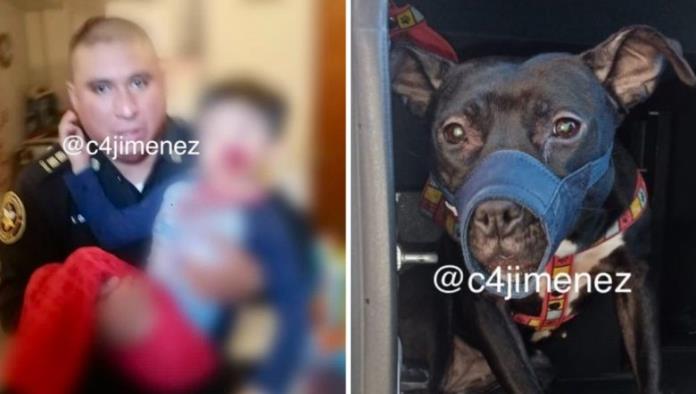 Niño de 5 años es mordido en la cara por un pitbull; policía lo rescata