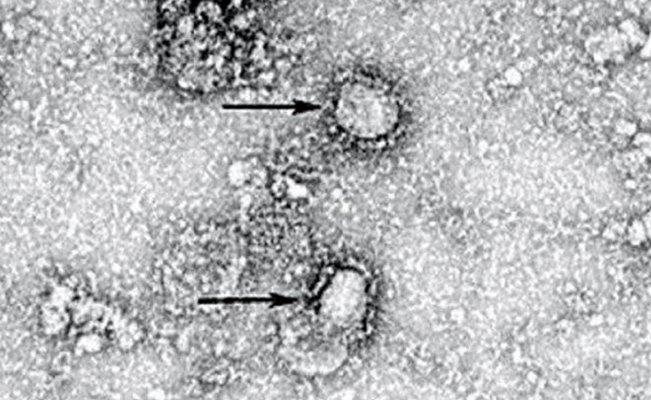 Primera foto de como se ve el coronavirus en un microscopio