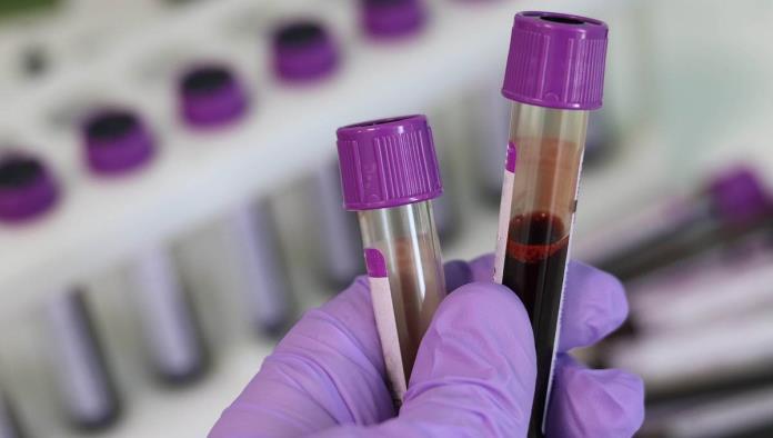 Prueba de sangre podría detectar el cáncer 4 años antes de que se manifieste