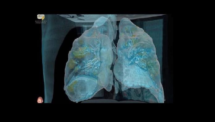 Un VIDEO de realidad virtual muestra cómo el coronavirus daña los pulmones en unos cuantos días