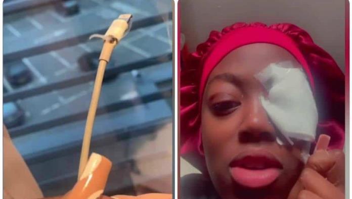 Cargador de teléfono explota y quema el ojo de una joven; impactante video se hace viral