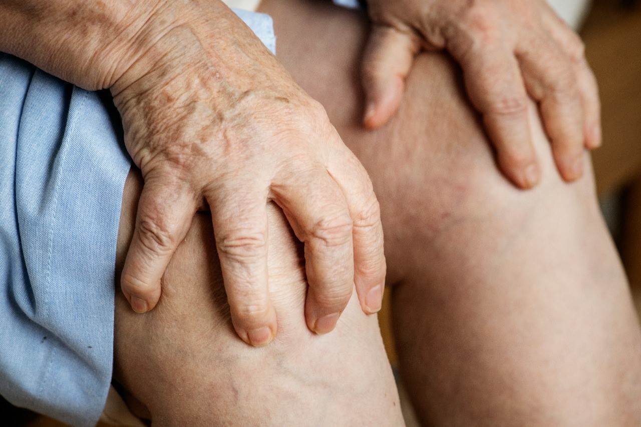 Atienden a pacientes  con Artritis Gotosa