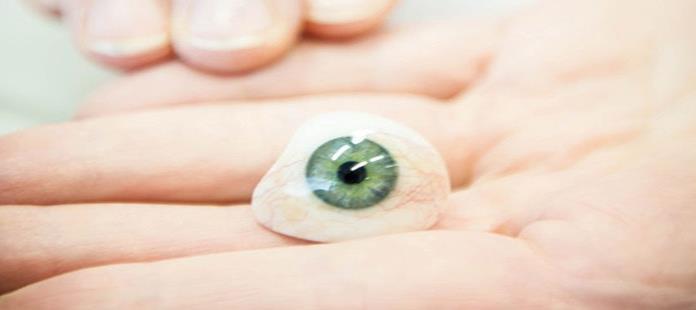 Un londinense recibirá la primera prótesis ocular impresa en 3D