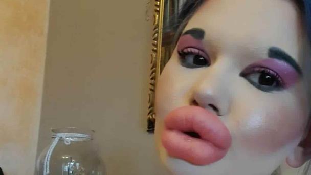 Influencer se opera para parecer una muñeca Bratz se vuelve viral