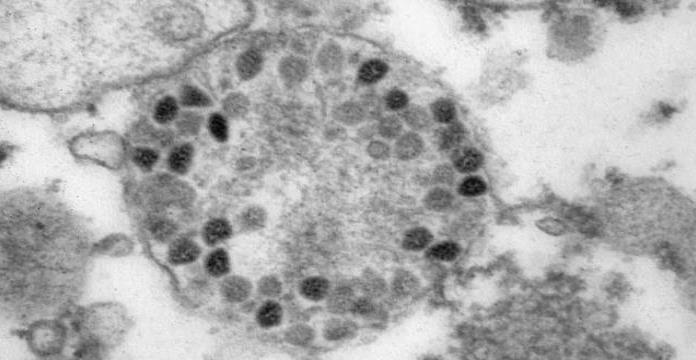 Variante Ómicron: Científicos de Rusia muestran fotos de cómo se ve el virus