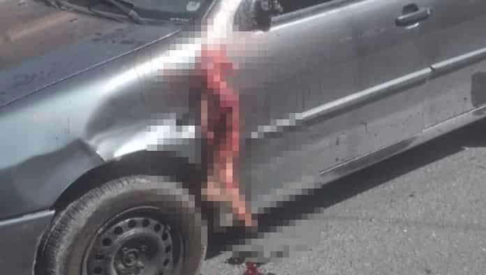 ¡Perturbador!, motociclista pierde una pierna en accidente