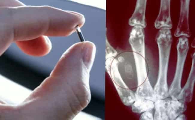 Microchip bajo la piel: se usa como identificación y medio de pago en Suecia