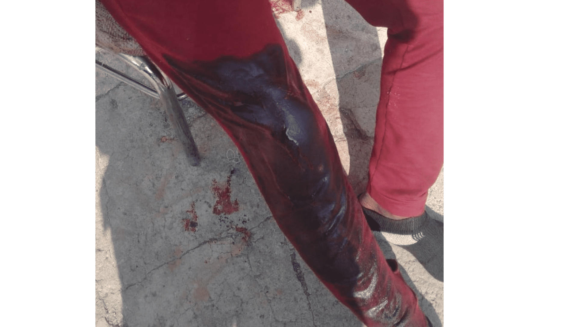 Un matrimonio haitiano se va a los golpes, esposa le entierra un cuchillo