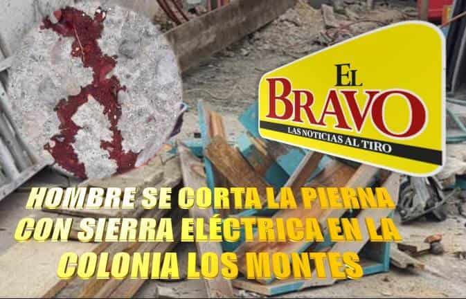 HOMBRE SE CORTA LA PIERNA CON SIERRA ELÉCTRICA EN LA COLONIA LOS MONTES
