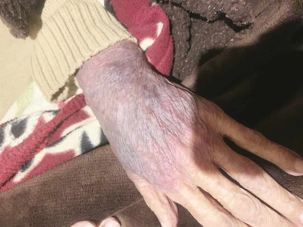 Los enfermeros de la Clínica 86 del IMSS le dejaron las muñecas desechas.