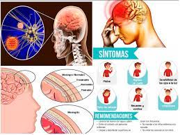 ¿Qué es la encefalitis?