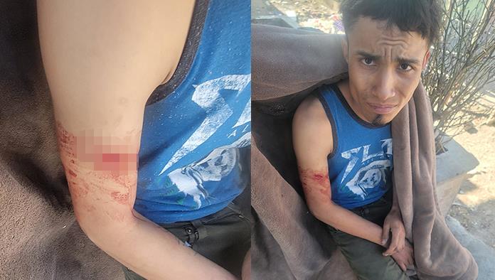 Múzquiz: Lo agreden con machete