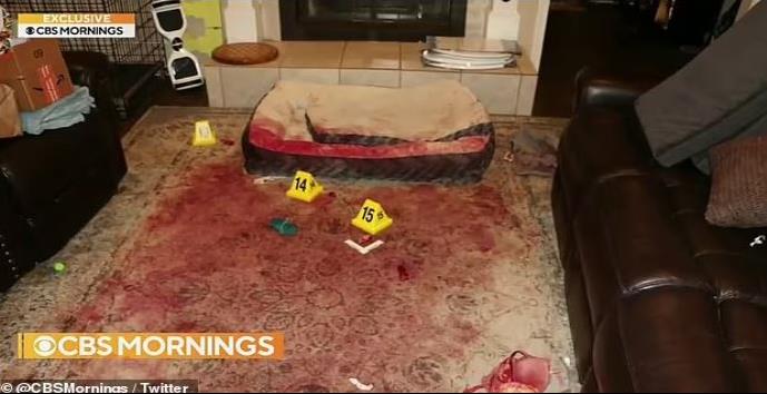 Quedo desfigurada tras ser atacada por 2 perros, la mordieron 800 veces