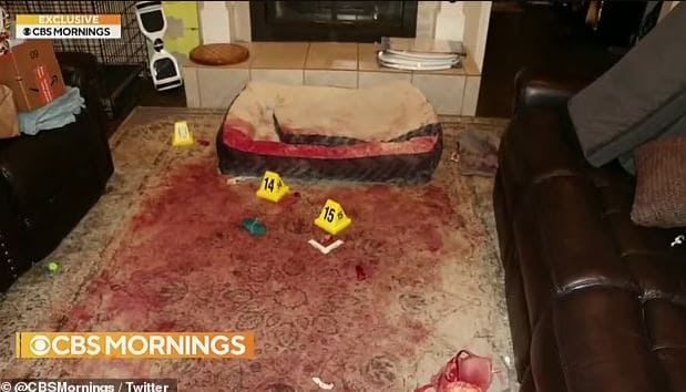 Quedo desfigurada tras ser atacada por 2 perros, la mordieron 800 veces