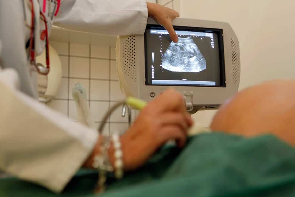 Las edades fluctúan de los 17 a los 39 años de edad.