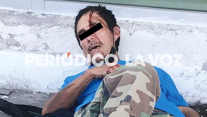 El herido resultó ser del sindicato de la Sección 288, fue auxiliado por sus compañeros quienes lo llevaron al hospital.