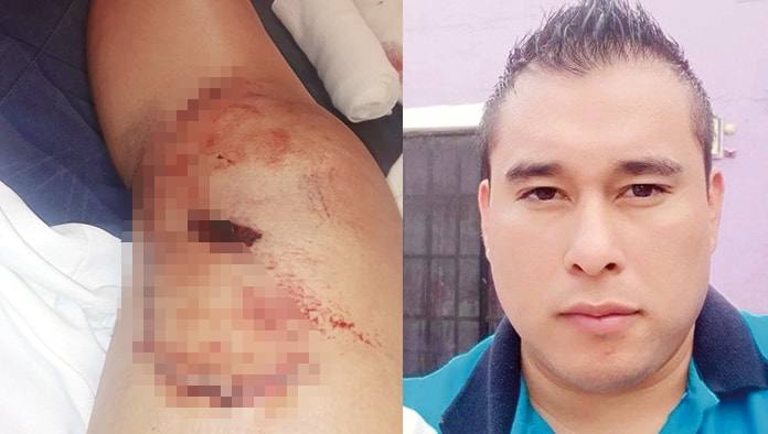 Angélica requirió de varios puntos en una de sus rodillas. Eliud Martínez Dávila (derecha) amenazó a la madre de sus hijos horas antes de echarle el taxi encima.