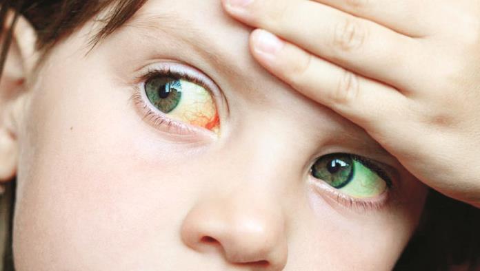 Alerta por llegada de hepatitis infantil